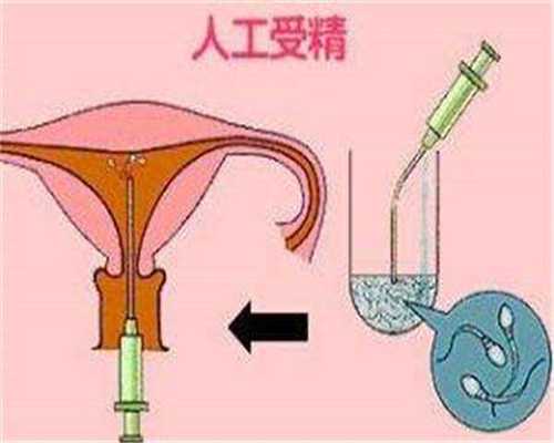 天津医院试管代孕,假性绝经赴美做试管婴儿可行吗？如何开展周期？-香港供卵